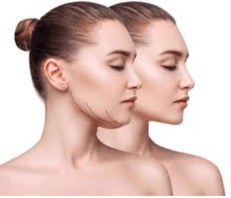 Top Facial Slimming Treatments Without Surgery in&hellip;